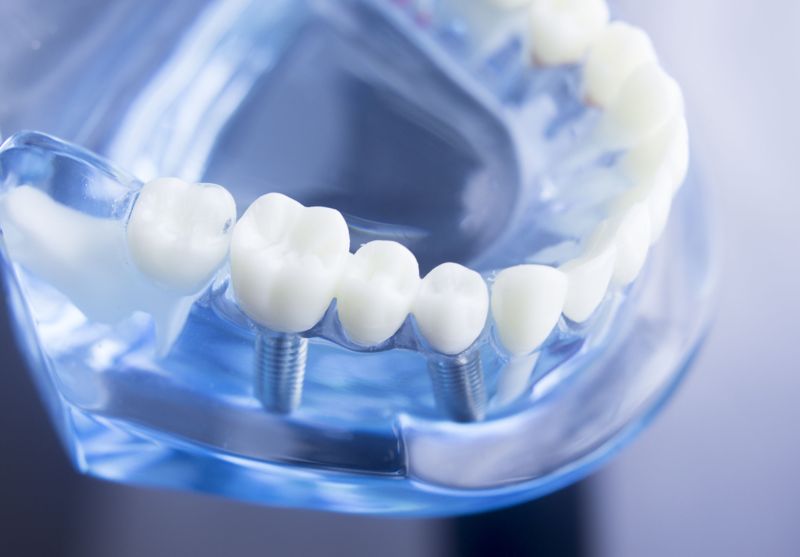 牙醫診所藉由自費療程提高顧客價值，該如何傳遞價值？